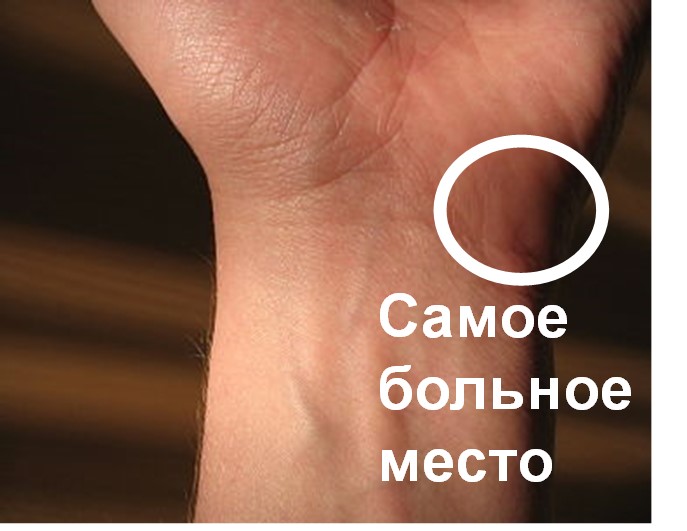 Zlotin